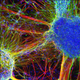 Illustration for article titled This is what schizophrenia looks like at the molecular level